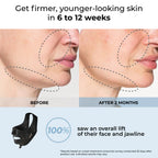 Medi Lift EMS Face Sculpting Mask (patented and wireless)